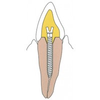 Dentatus USA #RST-L3